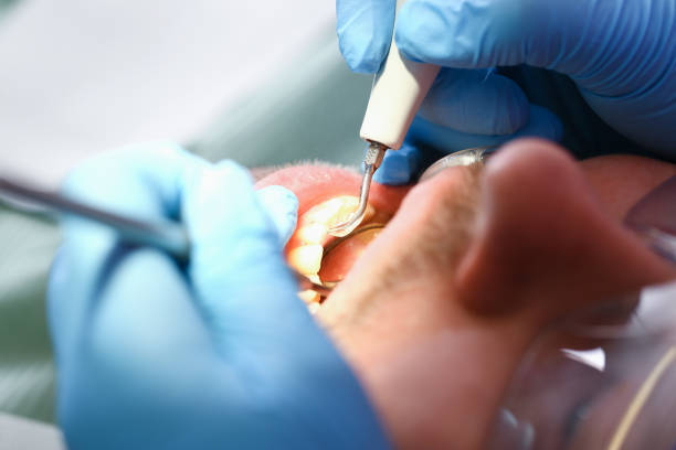 Best Emergency Dental Care for Trauma or Injury in West Wood, UT