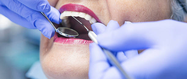 Best After-Hours Emergency Dentist in West Wood, UT